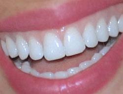 Colgate Optik Beyaz Diş Fırçası 2 Li Fırsat Paketi