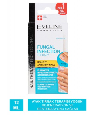 Eveline Fungal Infection Therapy ( Ayak Tırnak Terapisi ) 12 ml