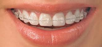 Gum Orthodontic Wax Mum :